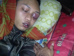 Kesulitan Berobat, Zulfikar TKI di Malaysia akan Dipulangkan