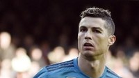 Menurutmu bagaimana sosok Ronaldo saat ini; tetap tampan-kah dirinya dengan bekas luka di wajahnya? (Foto: Jose Jordan/AFP PHOTO)