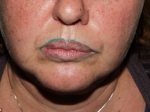 Gara-gara Tato Bibir, Wanita Ini Merasa Jadi Mirip Badut