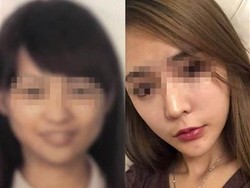 Terlalu Cantik Pasca Operasi Plastik, Wanita Ini Ditolak Naik Pesawat