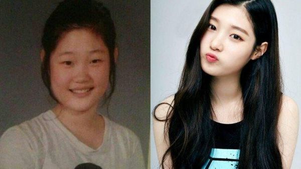 Foto: 15 Selebriti Korea yang Akui Operasi Plastik Demi Tampil Memesona