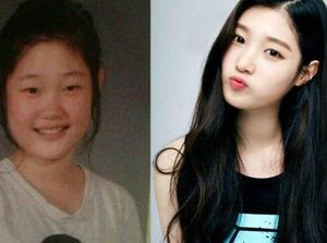 Foto: 15 Selebriti Korea yang Akui Operasi Plastik Demi Tampil Memesona