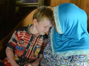 Ada Bocah Albino di Rembang yang Butuh Uluran Tangan