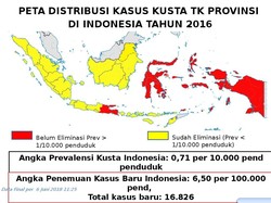 Indonesia Bertekad Eleminiasi Kusta di Tahun 2019