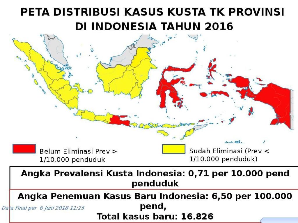 Indonesia Bertekad Eleminiasi Kusta di Tahun 2019 Indonesia Bertekad Eleminiasi Kusta di Tahun 2019