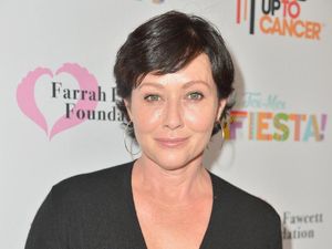 Menyoal Metastasis Kanker ke Otak, Dialami Shannen Doherty Sebelum Meninggal Menyoal Metastasis Kanker ke Otak, Dialami Shannen Doherty Sebelum Meninggal