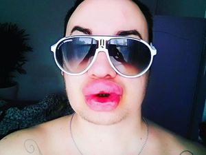 Pria Ini Habiskan Rp 95 Juta Demi Mirip Marilyn Monroe, Hasilnya Mengerikan