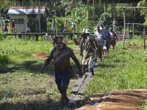 Data Kemensos: Masih Ada 651 Penderita Campak di Asmat, Ditangani RSUD