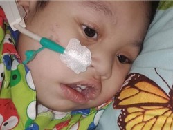 Bermula dari Tokso, Anak 2,5 Tahun Ini Masih Seperti Bayi