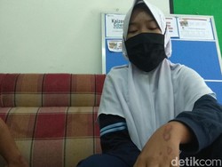 Siswi SMA di Karawang Ini Nekat Loncat dari Angkot Ugal-ugalan