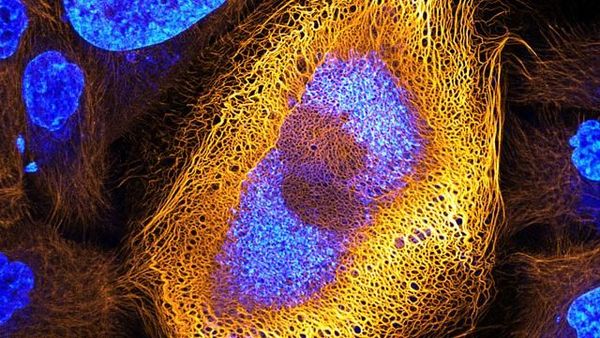 Karya Jawara Kontes Foto Mikro yang Bikin Mata Terpesona Karya Jawara Kontes Foto Mikro yang Bikin Mata Terpesona