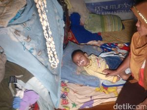 Terserang Miningitis, Bocah Cirebon Ini Makan Lewat Slang