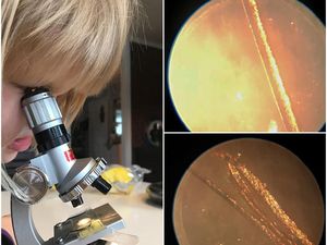 Objek-objek di Bawah Mikroskop yang Jadi Pengingat Untuk Hidup Sehat