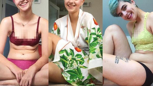 Connie Inglis, Mantan Pengidap Anoreksia yang Bangkit Pulihkan Berat Badan