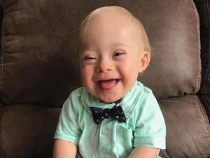 Kenalkan Ini Lucas, si Baby Gerber 2018 yang Menggemaskan