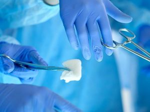 Tipu Suami agar Jual Ginjal, Istri Malah Bawa Kabur Uangnya Bareng Selingkuhan