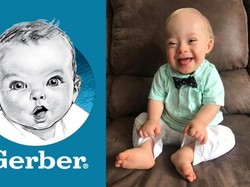 Bayi Lucu Ikon Gerber Tahun 2018 Ini Penyandang Down Syndrome