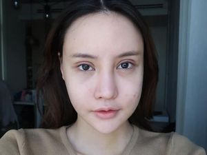 Beauty is Pain, Transformasi Cewek Thailand 3 Bulan Setelah Operasi Plastik