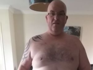 Mantan Bodyguard Artis Mengidap Hernia 31 Kilogram, Terbesar di Dunia