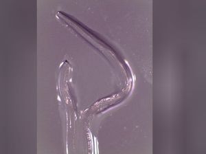 Hii! Dokter Angkat 14 Cacing dari Mata Wanita Ini