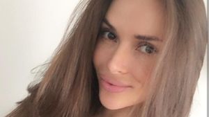 Foto: Sosok Yulia, Wanita dengan Payudara Persegi Akibat Gagal Implan