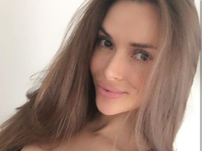 Foto: Sosok Yulia, Wanita dengan Payudara Persegi Akibat Gagal Implan