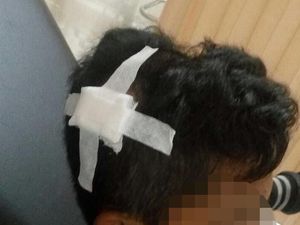 3 Bocah Korban Penganiayaan Pengamen di Bandung Alami Trauma