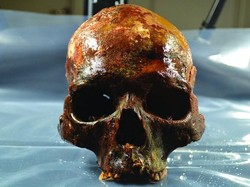 Tengkorak 8.000 Tahun Ditemukan di Bekas Danau Swedia