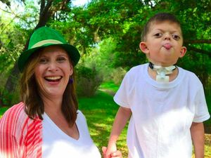 Tega Banget! Foto Bocah dengan Kondisi Langka Malah Dijadikan Meme