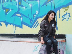 Ngeri Banget! Dinda Kirana Patah Tulang Saat Main Skate Board