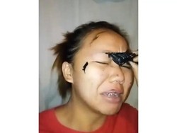 Pakai Masker Peel Off, Alis Wanita Ini Ikut Tercabut Hingga Hampir Botak