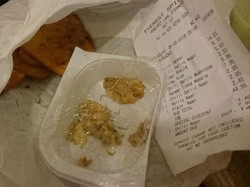 Waduh! Pembeli Temukan 12 Buah Isi Strapler Dalam Kentang yang Dibeli dari Restoran