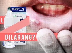 Paling Ngagetin di 2018: Kontroversi dr Terawan, Heboh Albothyl Dilarang