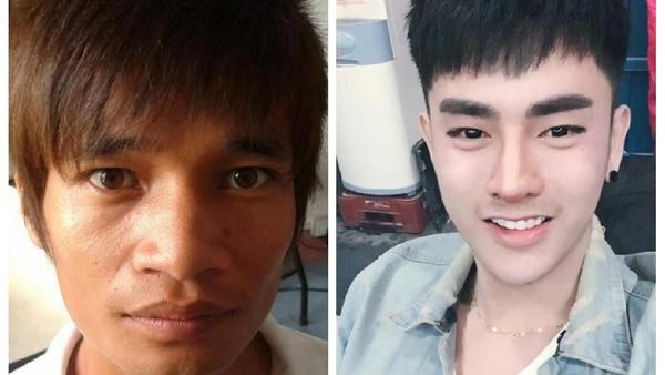 Terpana! Potret Transformasi Pria Biasa Operasi Plastik Mirip Idol Korea