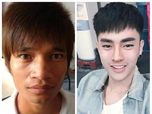 Terpana! Potret Transformasi Pria Biasa Operasi Plastik Mirip Idol Korea