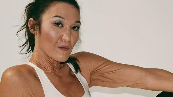 Cerita Sara, Model Berumur 26 Tahun yang Terperangkap di Tubuh Lansia