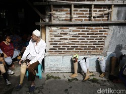 Ada Bercak di Kulit dan Tak Terasa, Curigai Kusta