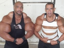 Cerita Dua Bersaudara yang Demi Otot Suntikkan Bahan Kimia Berbahaya