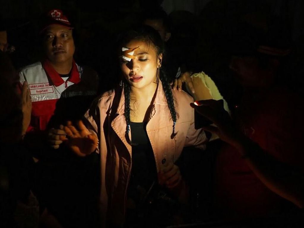Alami Insiden saat Manggung, Pelipis Tantri Kotak Dapat 8 Jahitan Alami Insiden saat Manggung, Pelipis Tantri Kotak Dapat 8 Jahitan