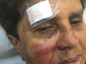 Kendarai Skuter, Perempuan Lansia di Australia Diserang Geng Remaja