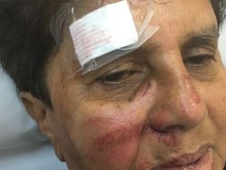 Kendarai Skuter, Perempuan Lansia di Australia Diserang Geng Remaja