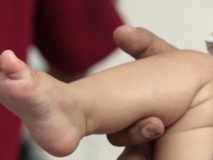 Islandia Ingin Larang Sunat, Tokoh Islam, Yahudi dan Katolik Protes