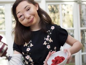 Gadis yang Menangis Darah Ini Diobati dengan Obat Kanker