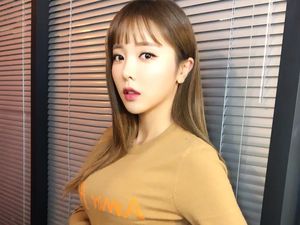Gaya Hong Jinyoung Pasca Oplas Gaya Hong Jinyoung Pasca Oplas
