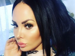 Penyesalan Wanita yang Pasang Implan di Bokong Senilai Rp 285 Juta