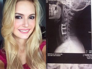 Pernah Kecelakaan Saat Sit Up dan Menjadi Lumpuh, Wanita Ini Bisa Bangkit