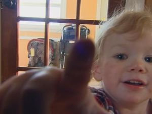 Foto: Ivy Angerman, Bocah Umur 18 Bulan Yang Mengidap Alergi Air Langka