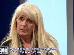 Dari Peyot Jadi Kencang, Perubahan Transgender Pasca Oplas Rp 537 Juta