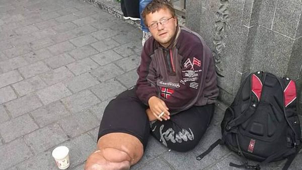 Bule-bule Nelangsa di Indonesia: Ongkos Habis hingga Jadi Gelandangan