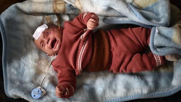 Foto: Bayi Karim Bermata Satu yang Sembunyi karena Serangan Assad